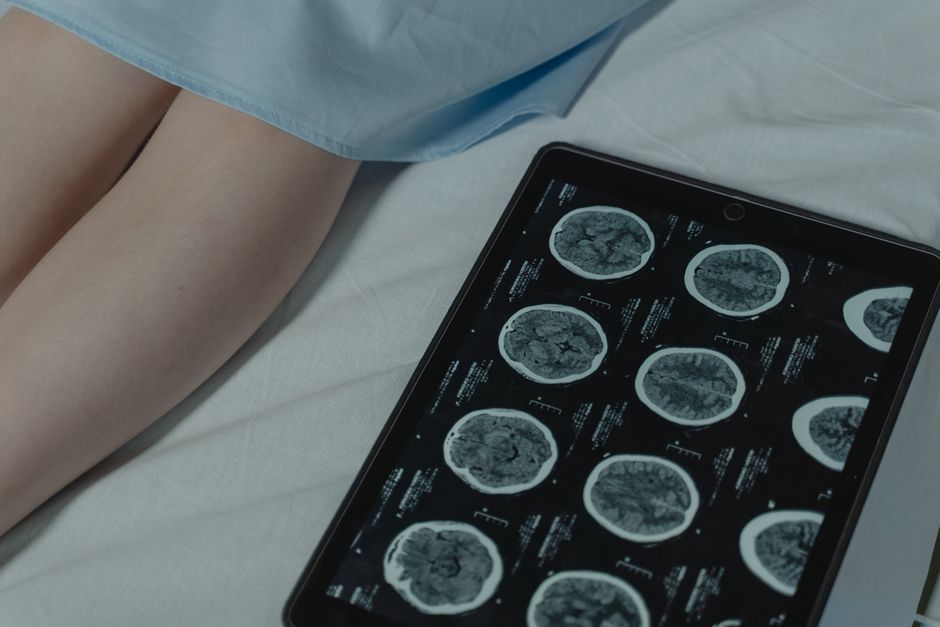 Close-up of brain CT scan display on tablet beside patient legs in a hospital room.